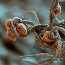 Attēlu rezultāti vaicājumam “Physarum bivalve spores”