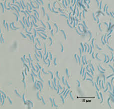 Attēlu rezultāti vaicājumam “Rhytisma acerinum”