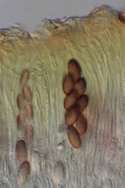 Attēlu rezultāti vaicājumam “Ascobolus furfuraceus”