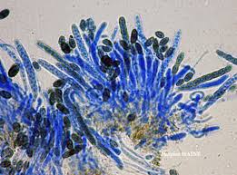 Attēlu rezultāti vaicājumam “Calicium salicinum”