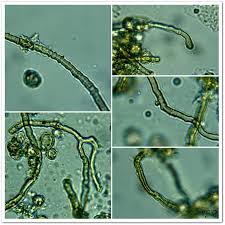 Attēlu rezultāti vaicājumam “Oligonema flavidum spores”
