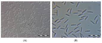 Attēlu rezultāti vaicājumam “Cribraria martinii spores”