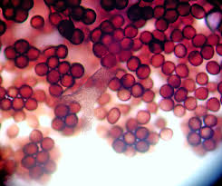 Attēlu rezultāti vaicājumam “Badhamia capsulifera var. arborea”