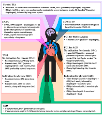 Image result for Rossington Asc