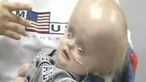 Image result for no brain