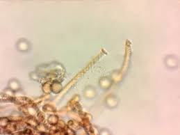 Attēlu rezultāti vaicājumam “Hemitrichia leiotricha macro”