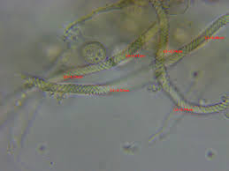 Attēlu rezultāti vaicājumam “Trichia ambigua spores”
