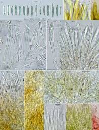 Attēlu rezultāti vaicājumam “Lachnum corticale”