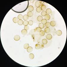 Attēlu rezultāti vaicājumam “Licea minima sessile”