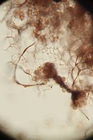 Attēlu rezultāti vaicājumam “Stemonitis virginiensis”