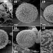 Attēlu rezultāti vaicājumam “Arcyria affinis capillitium”