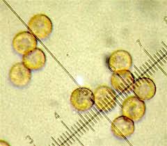 Attēlu rezultāti vaicājumam “Comatricha tenerrima spores”