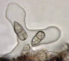 Attēlu rezultāti vaicājumam “Stemonitopsis hyperopta var. landewaldii spores”