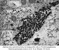 Filoviruses