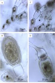 Attēlu rezultāti vaicājumam “Bulbochaete mirabilis”