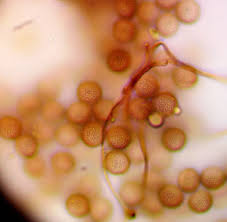 Attēlu rezultāti vaicājumam “Lycogala ustulatum macro”