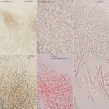 Attēlu rezultāti vaicājumam “Perenniporia medulla-panis”