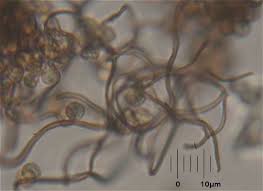 Attēlu rezultāti vaicājumam “Comatricha alta stalked”