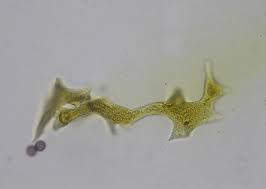 Attēlu rezultāti vaicājumam “Physarum decipiens spores”