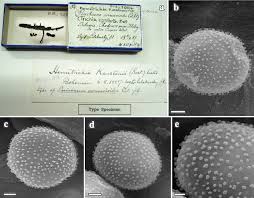 Attēlu rezultāti vaicājumam “Perichaena corticalis spores”