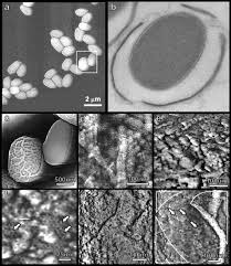 Attēlu rezultāti vaicājumam “Enteridium variabile spores”