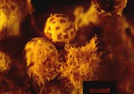 Attēlu rezultāti vaicājumam “Trichia erecta spores”