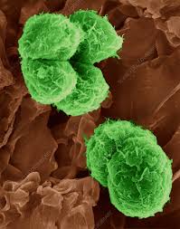 Attēlu rezultāti vaicājumam “Pleurococcus vulgaris”