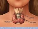 Overactive and Underactive Thyroids Overactive and Underactive ...