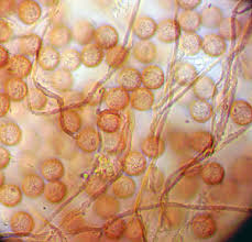 Attēlu rezultāti vaicājumam “Diderma effusum macro”