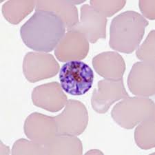 Attēlu rezultāti vaicājumam “Badhamia lilacina plasmodium”