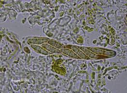 Attēlu rezultāti vaicājumam “Coenogonium pineti”