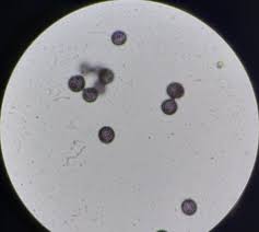 Attēlu rezultāti vaicājumam “Didymium proximum stalked”