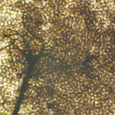 Attēlu rezultāti vaicājumam “Collaria arcyrionema spores”