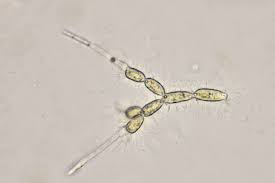 Attēlu rezultāti vaicājumam “Bulbochaete mirabilis”