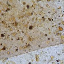 Attēlu rezultāti vaicājumam “Badhamia affinis var. microspora”