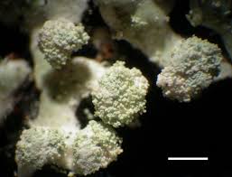 Attēlu rezultāti vaicājumam “Menegazzia terebrata”