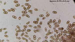 Attēlu rezultāti vaicājumam “Calicium viride”