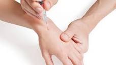Treatments for Osteoarthritis in Hands | Arthritis-health