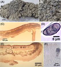 Attēlu rezultāti vaicājumam “Physcia aipolia”