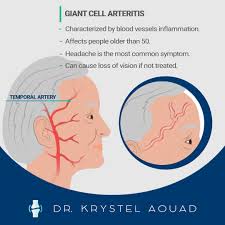 Image result for GCA