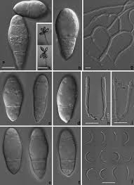 Attēlu rezultāti vaicājumam “Orbilia sp.”