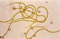 Attēlu rezultāti vaicājumam “Trichia varia sessile”