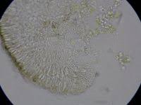 Attēlu rezultāti vaicājumam “Scoliciosporum chlorococcum”