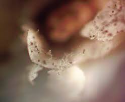 Attēlu rezultāti vaicājumam “Diderma globosum macro”