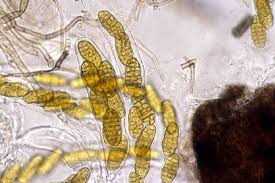 Attēlu rezultāti vaicājumam “Stemonitopsis aequalis var. microspora”