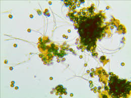 Attēlu rezultāti vaicājumam “Didymium minus”