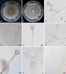 Attēlu rezultāti vaicājumam “Trichia ambigua spores”