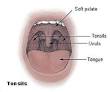 Tonsil - Wikipedia, the free encyclopedia