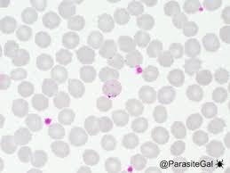 Attēlu rezultāti vaicājumam “Reticularia lobata plasmodium”