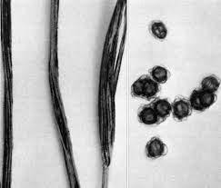 Attēlu rezultāti vaicājumam “Urocystis anemones spores”